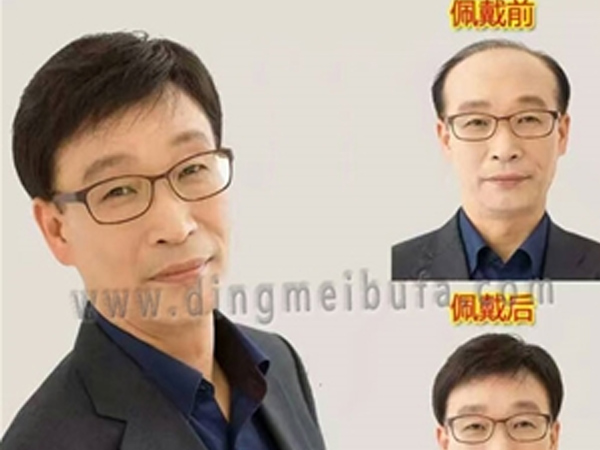 南陽男士補發(fā)定制 南陽男士補發(fā)定制