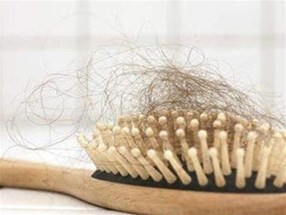 常見的脫發(fā)類型都有哪些？分別是什么癥狀？