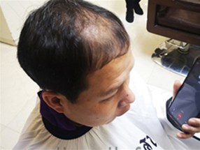 男士補發(fā)有哪些好處呢？