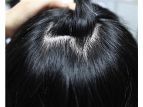 補(bǔ)發(fā)后，一般具有哪些特征呢？