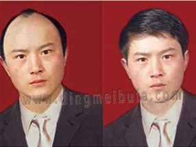 使用假發(fā)的禁忌有哪些？